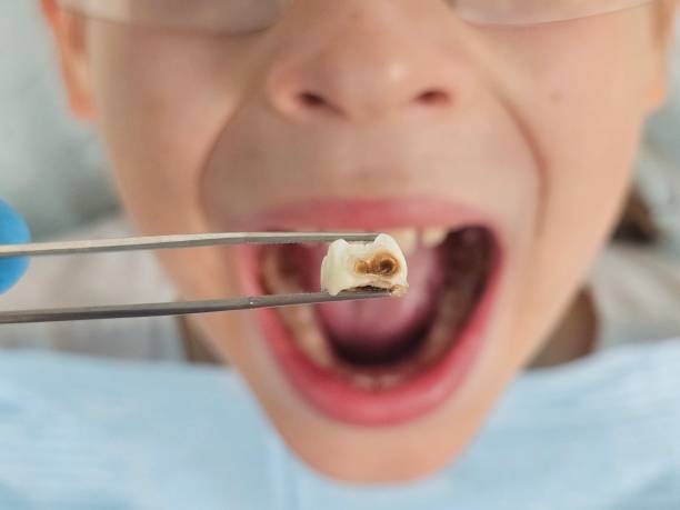 Best Dentist Open Late Near Me  in Clinton, OK